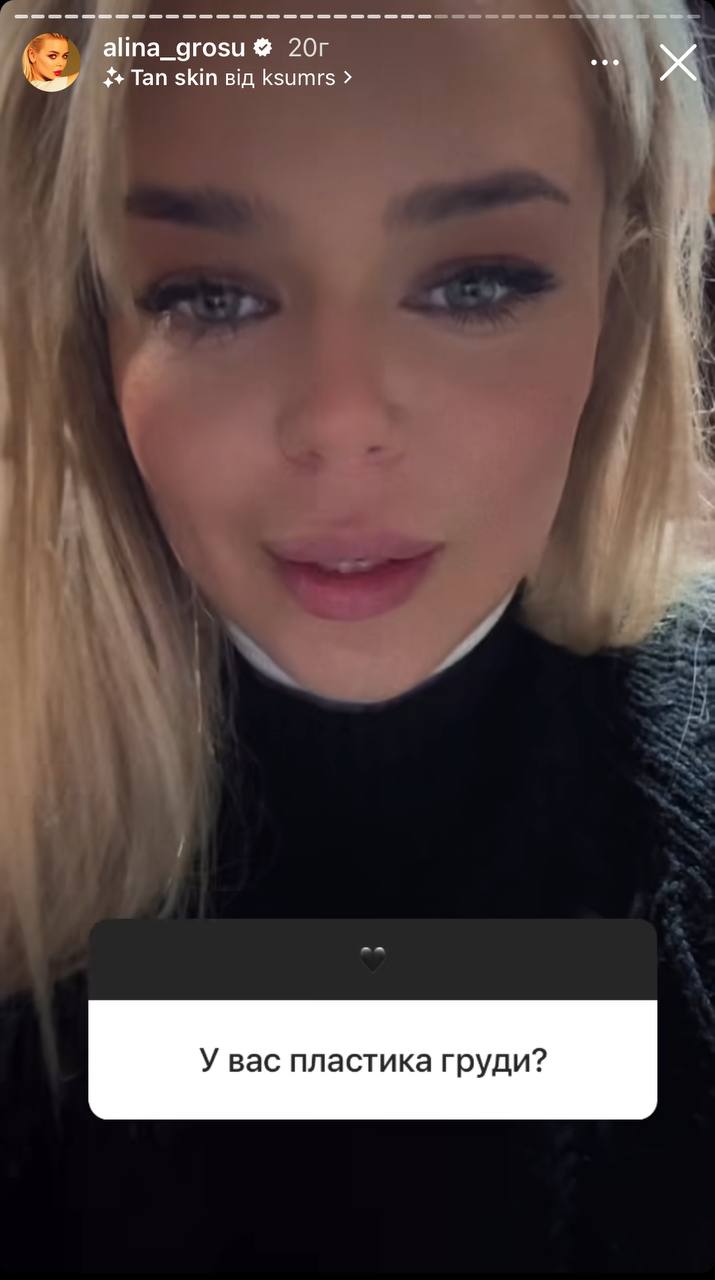 Алина Гросу призналась, делала ли пластику груди